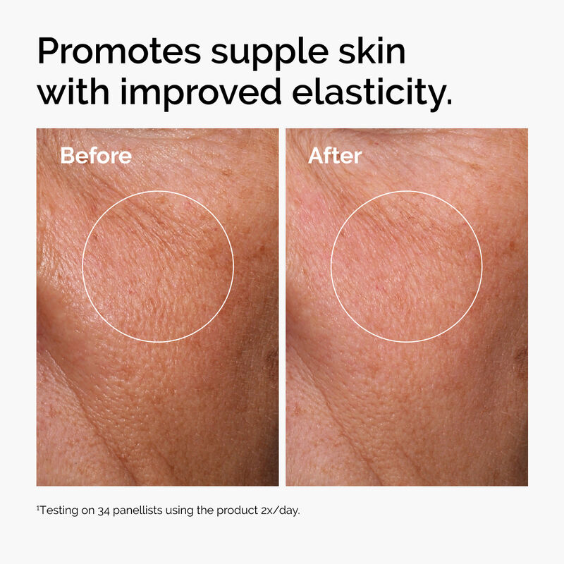 Before and after skin elasticity results using The Ordinary Hyaluronic Acid 2% + B5
