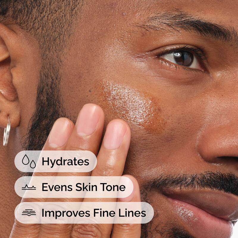 Applying The Ordinary Retinol 1% in Squalane to hydrate and even skin tone